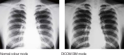 G series Epson - X ray - DICOM on right